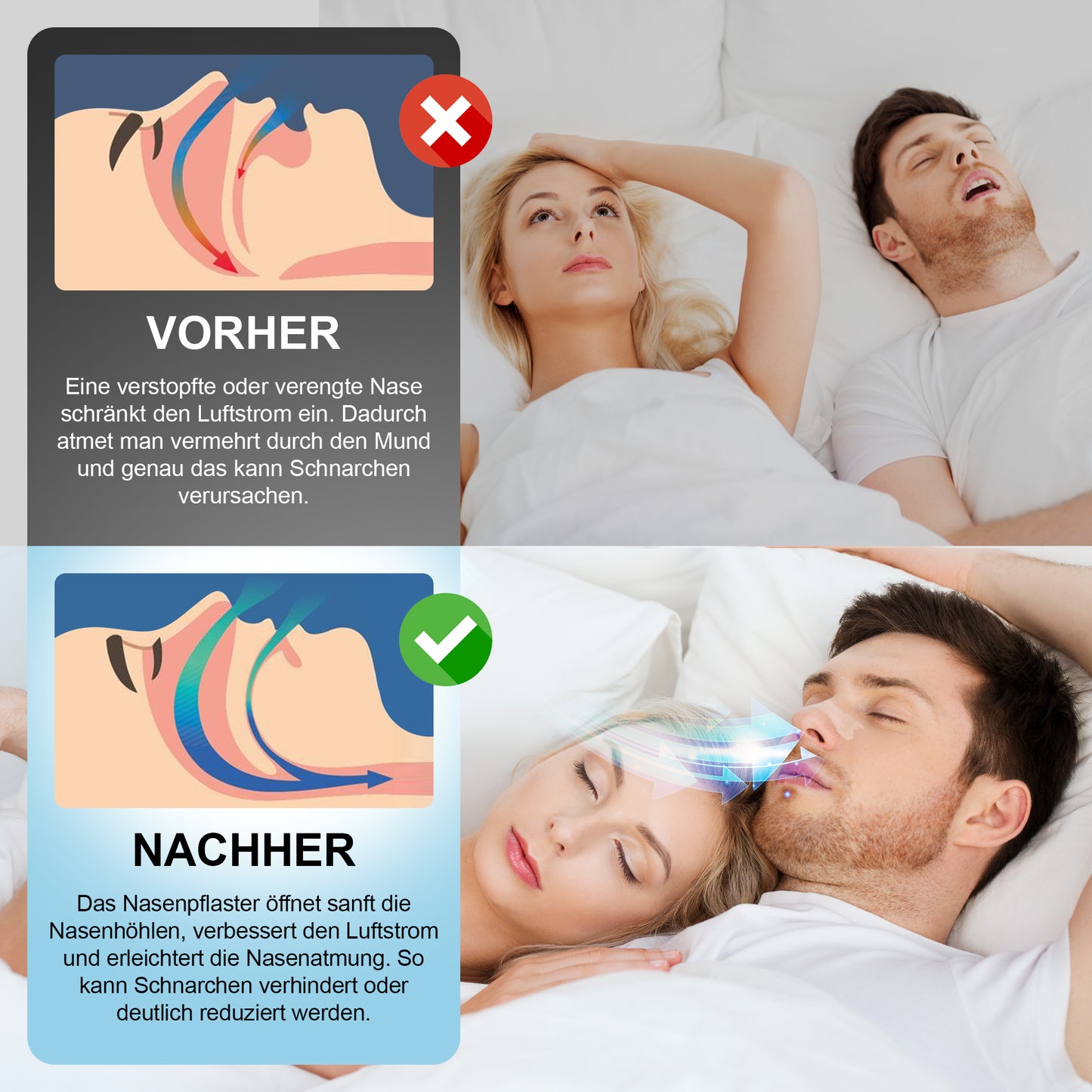 80er Nasenpflaster Premium - Transparent - Vorteilspackung